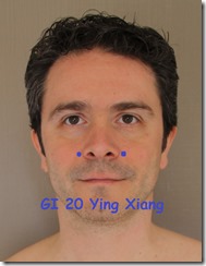 Point acupuncture GI 20 Ying Xiang allergies sphère ORL 